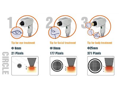 Kosmetikgerät, Hautstraffung mit Thermage, Thermage-Behandlung